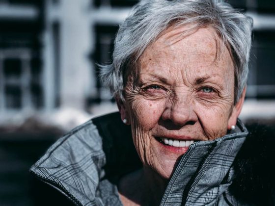 Superior Filler That Will Successfully Take away the Indicators of Ageing