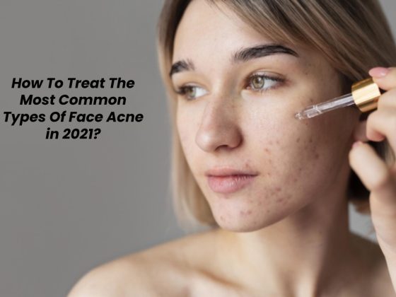 How To Deal with The Most Widespread Varieties Of Face Pimples in 2021