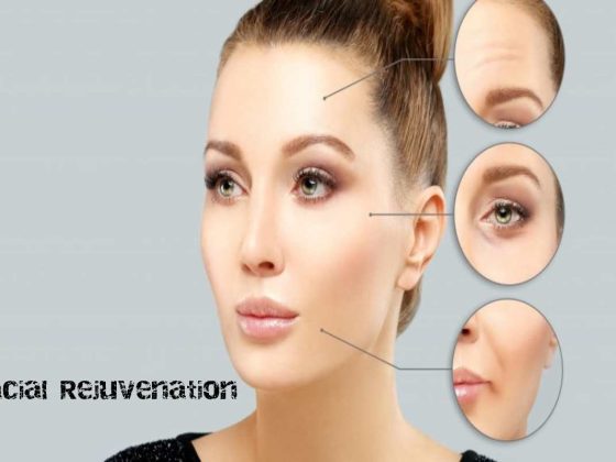 Facial Rejuvenation and How It Helps General Facial Well being