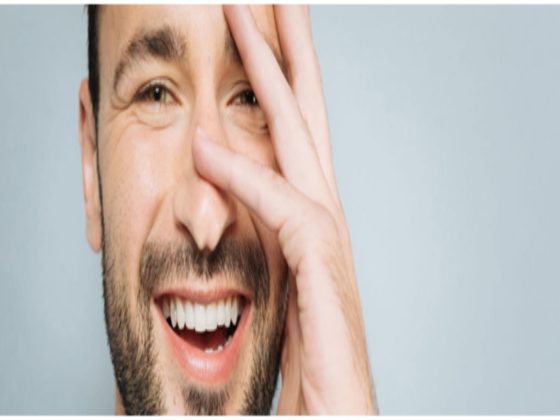 Smile Makeover with Dental Veneers