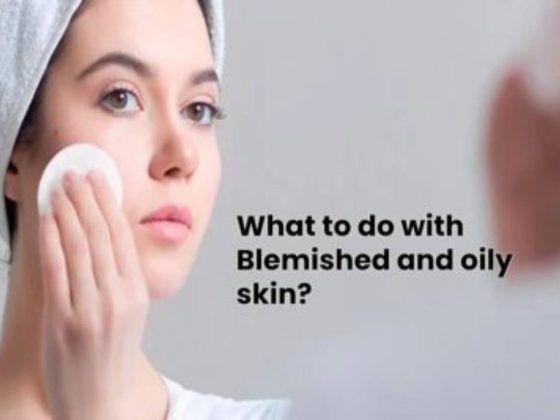 What to Do with Blemished and oily pores and skin? – Divine Magnificence Suggestions