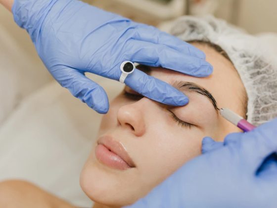 What Is a Brow Lift?