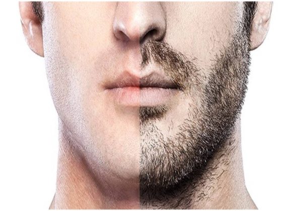 Let’s dispel some myths about beard transplant.